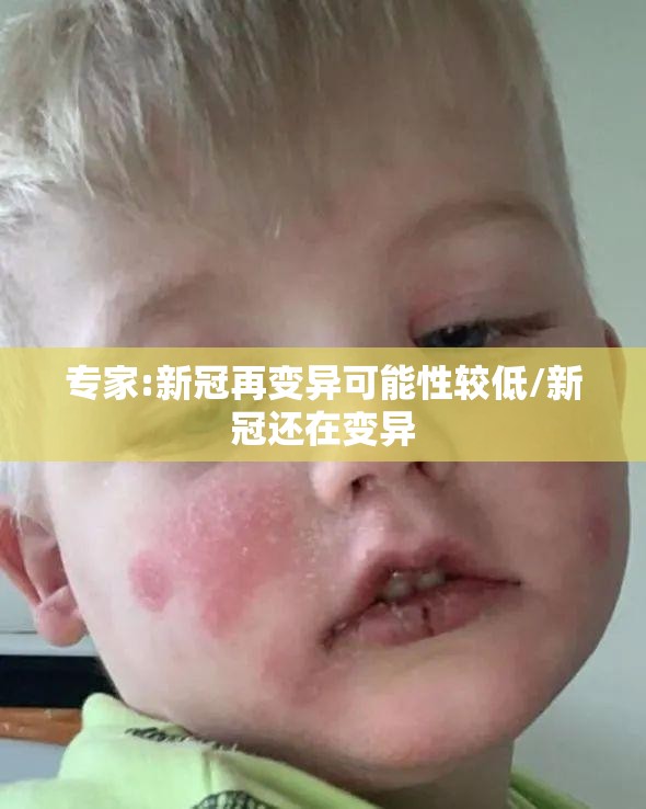 专家:新冠再变异可能性较低/新冠还在变异