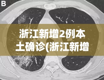 浙江新增2例本土确诊(浙江新增2例新冠肺炎)
