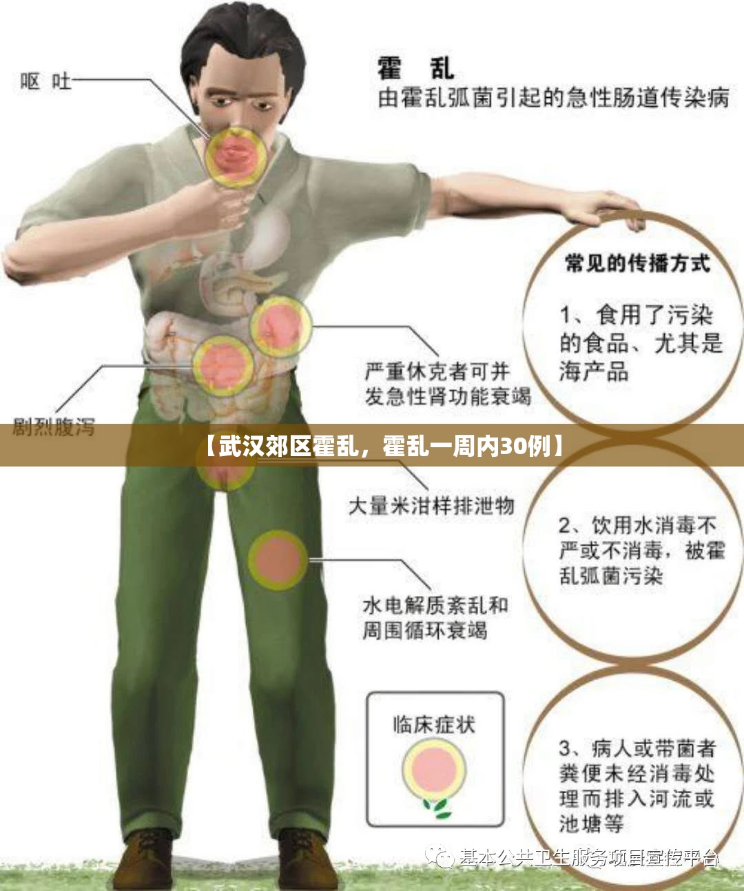 【武汉郊区霍乱，霍乱一周内30例】