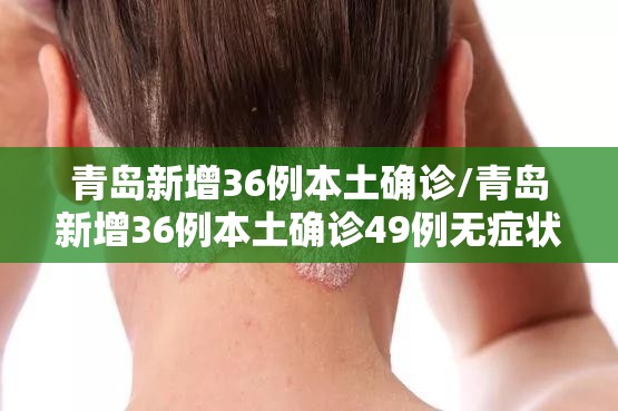 青岛新增36例本土确诊/青岛新增36例本土确诊49例无症状