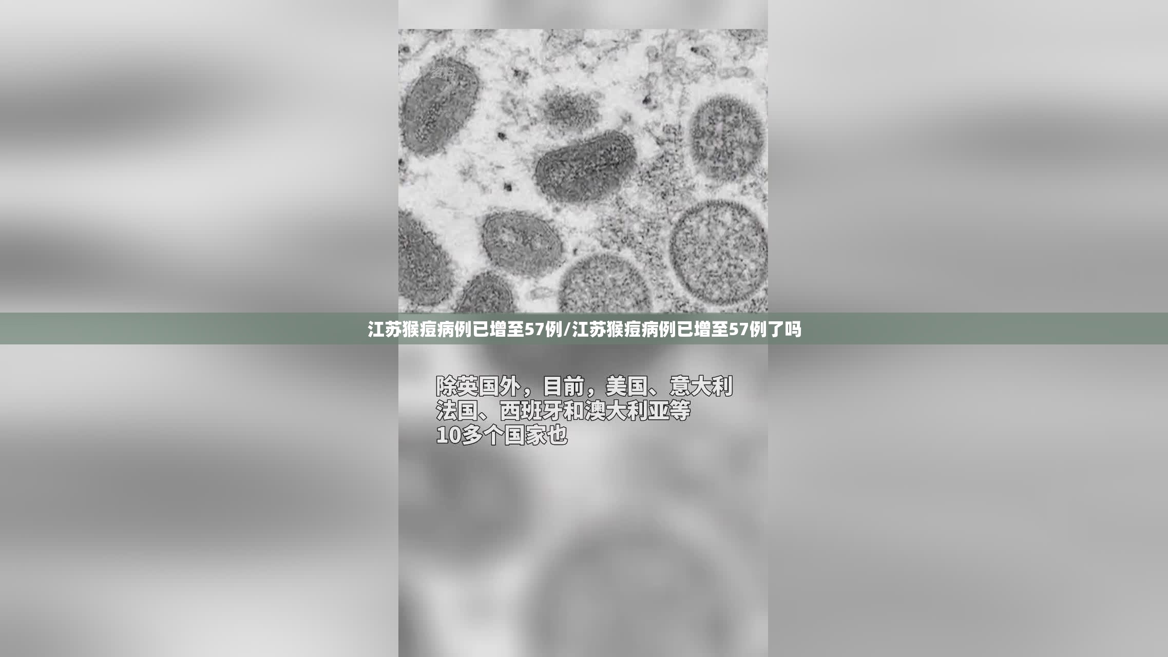 江苏猴痘病例已增至57例/江苏猴痘病例已增至57例了吗