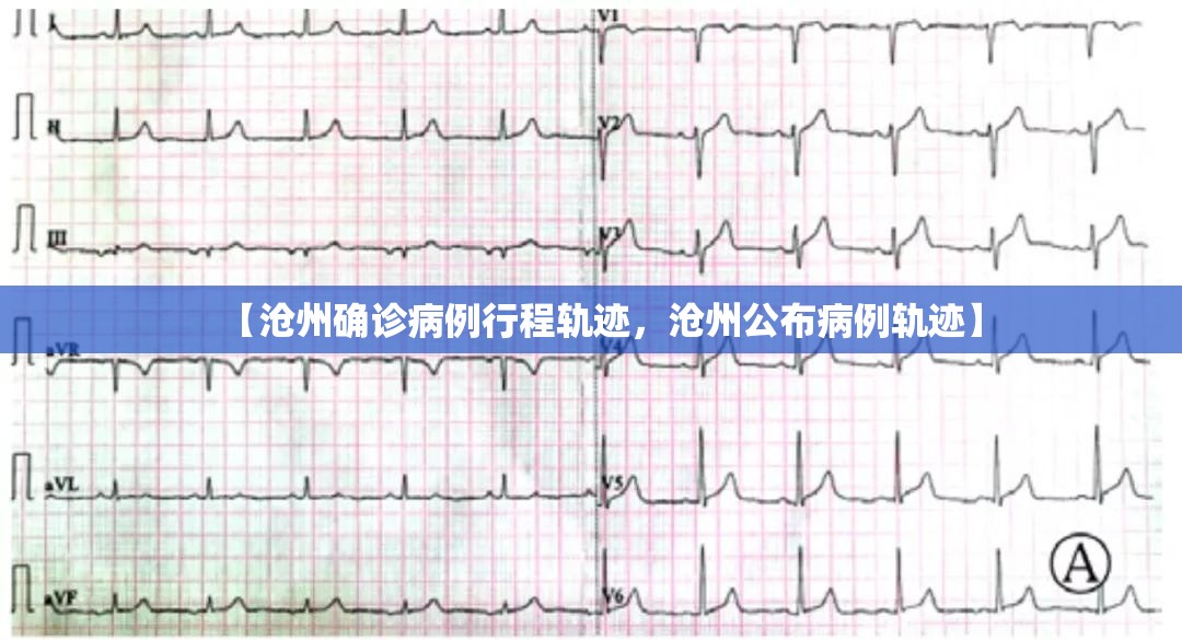 【沧州确诊病例行程轨迹，沧州公布病例轨迹】