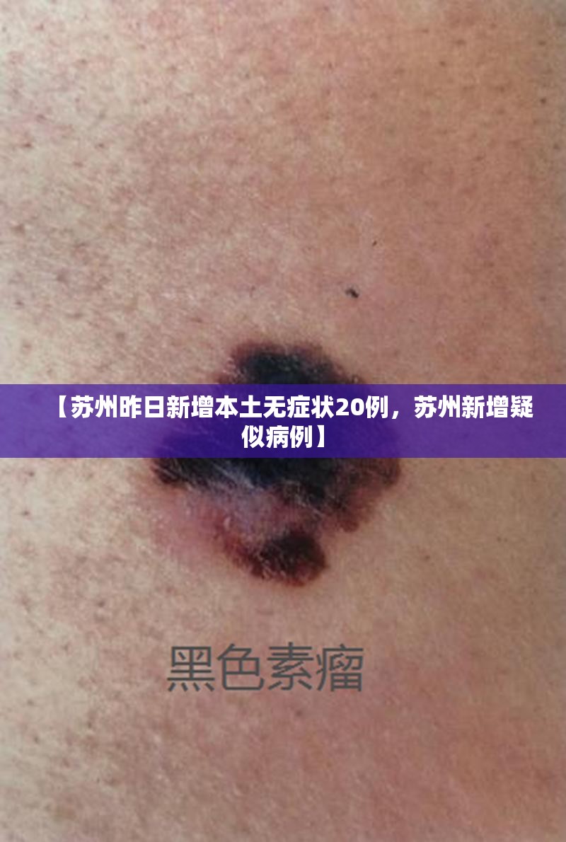 【苏州昨日新增本土无症状20例，苏州新增疑似病例】