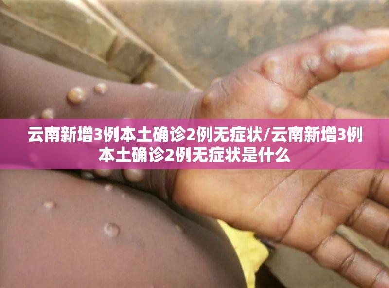 云南新增3例本土确诊2例无症状/云南新增3例本土确诊2例无症状是什么