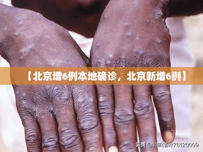 【北京增6例本地确诊，北京新增6例】