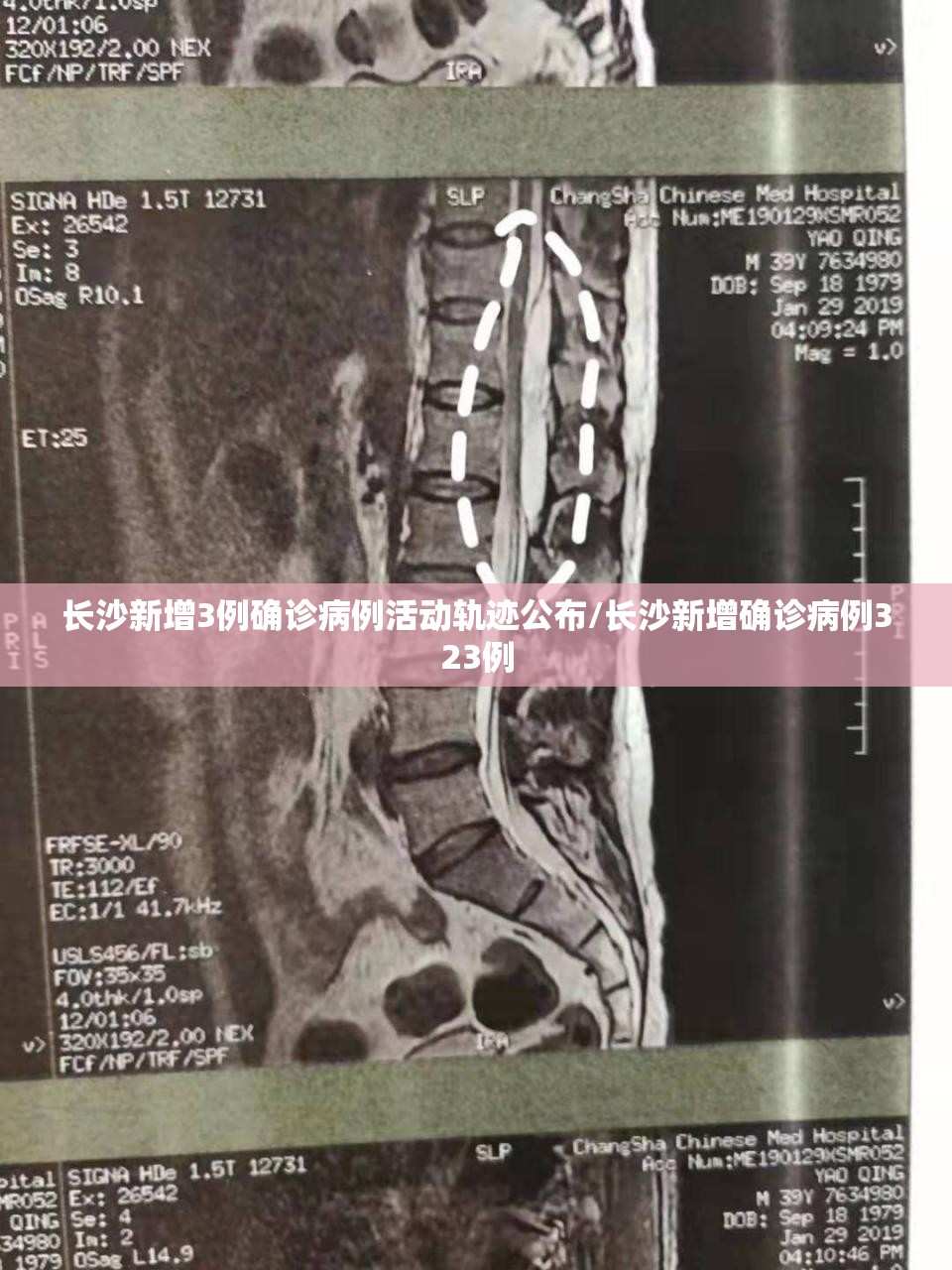 长沙新增3例确诊病例活动轨迹公布/长沙新增确诊病例323例