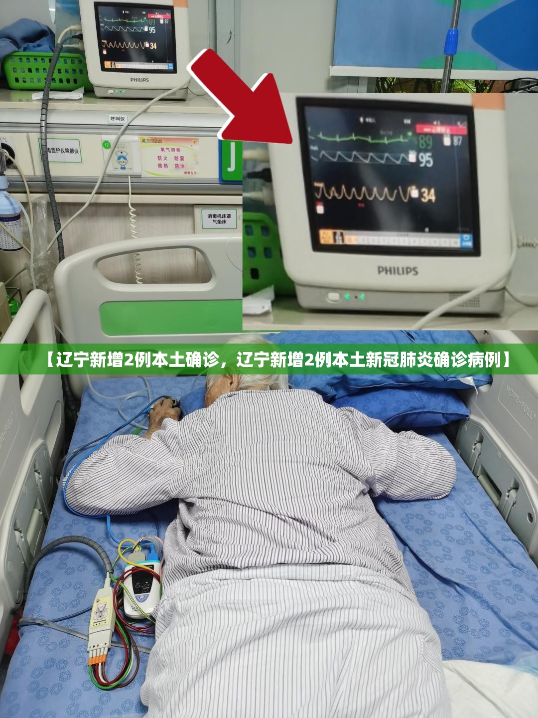 【辽宁新增2例本土确诊，辽宁新增2例本土新冠肺炎确诊病例】